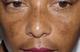Images 2025 06 13t172032.063
