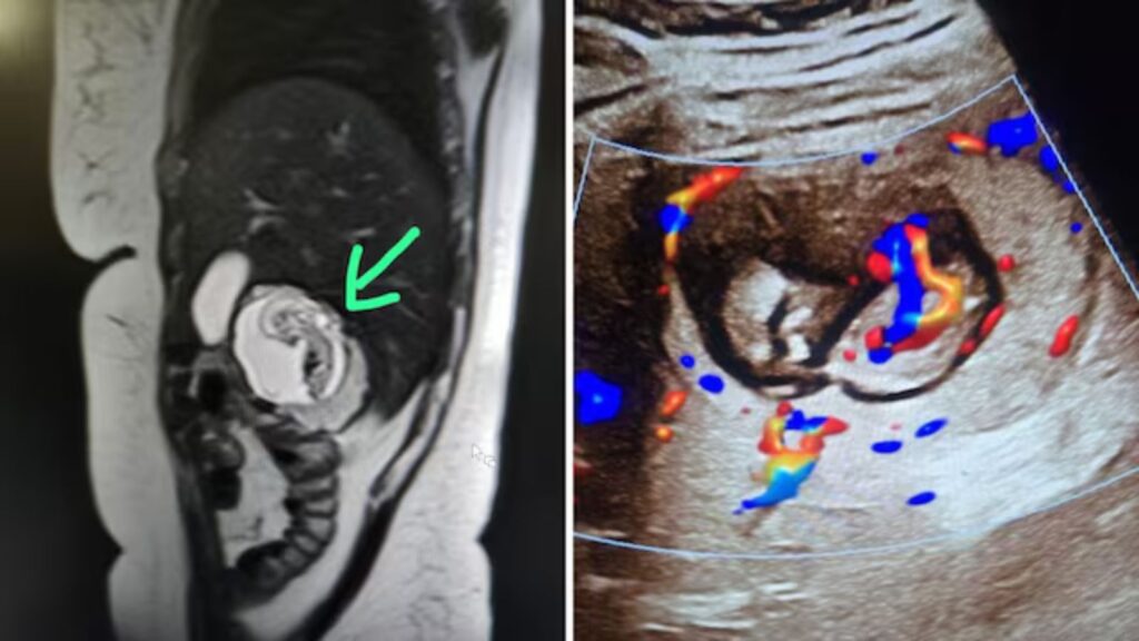 Untitled design 2025 07 28t200348.851