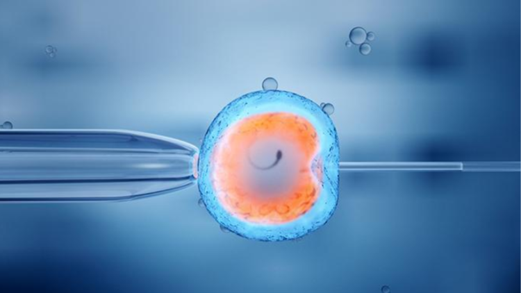 Untitled design 2026 02 27T175040.157