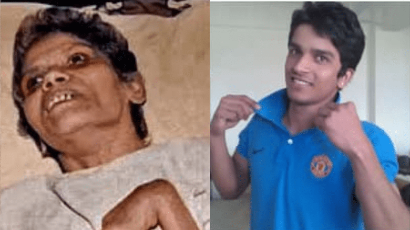 ಏನಿದು ದಯಾಮರಣ ? ಮರಣದ ಹಕ್ಕಿಗೆ ಬುನಾದಿ ಹಾಕಿದ ಅರುಣಾ ಶಾನ್‌ಬಾಗ್ ಮನಕಲಕುವ ಕಥೆ ನಿಮಗೊತ್ತೇ ?