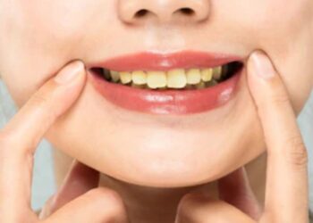 BeFunky collage (76)