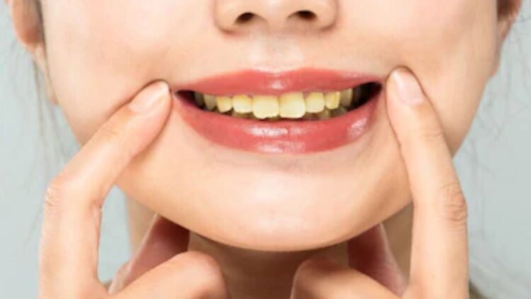 BeFunky collage (76)