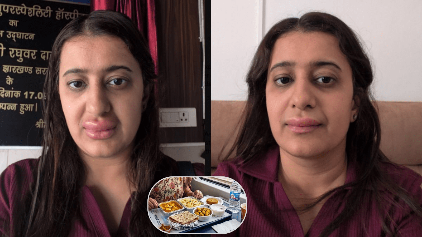 ವಂದೇ ಭಾರತ್ ಎಕ್ಸ್‌ಪ್ರೆಸ್ ರೈಲಿನಲ್ಲಿ ಊಟ ಸೇವಿಸಿ ಅಲರ್ಜಿ: ಮಹಿಳೆ ಹಂಚಿಕೊಂಡ ಫೋಟೋ ವೈರಲ್