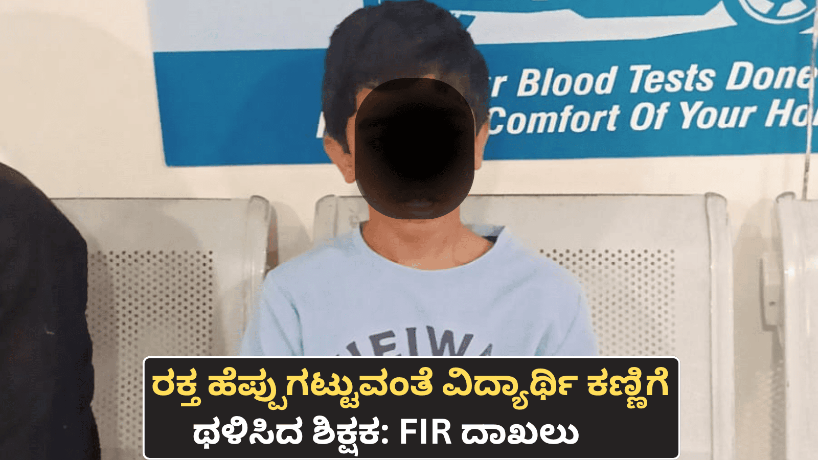 ರಕ್ತ ಹೆಪ್ಪುಗಟ್ಟುವಂತೆ ವಿದ್ಯಾರ್ಥಿ ಕಣ್ಣಿಗೆ ಥಳಿಸಿದ ಶಿಕ್ಷಕ: FIR ದಾಖಲು